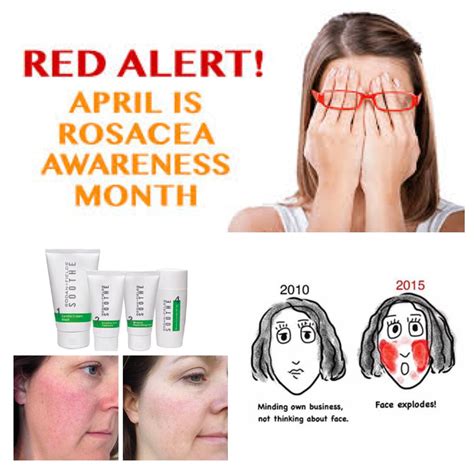 Did You Know That April Is Rosacea Awareness Month According To The