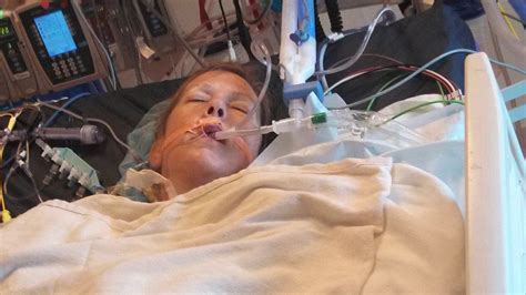 Dental Procedure Leads Woman To Have Open Heart Surgery Who