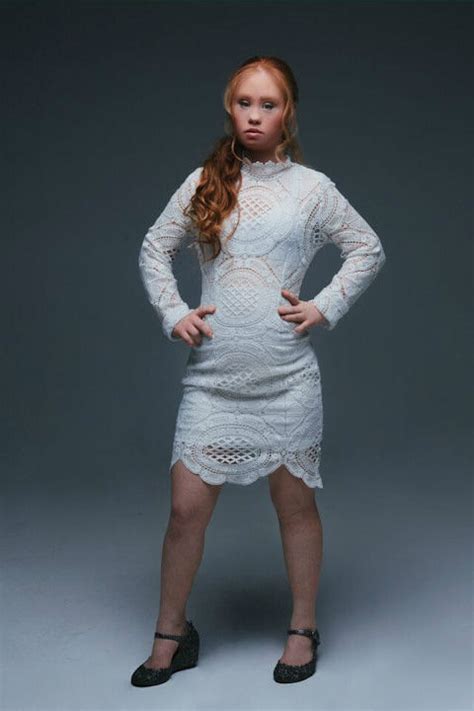 Photos Madeline Stuart 18 Year Old Model With Down Syndrome To Walk At New York Fashion Week