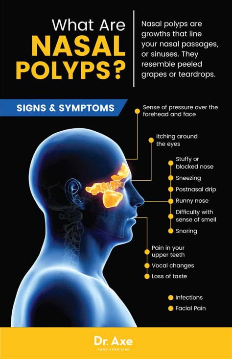 Nasal Polyps Natural Treatments Lifestyle Changes Best Pure Essential Oils