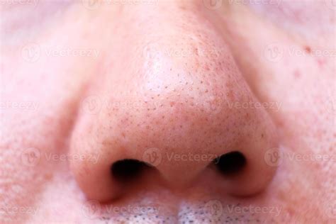 Close Up Nose On Skin And Skin Care Concept And Complete Skin Solutions