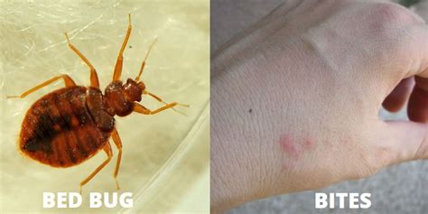 Bed Bug Bites Vs Dust Mites In 7 Points Explained Y L P C