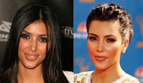 Kim Kardashian Before And After Plastic Surgery Networth Height Salary