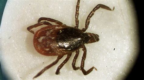 Rare Tick Borne Powassan Virus Worries Some Experts About Possible Spread