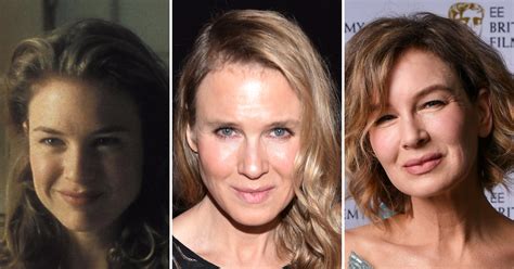 renee zellweger before and after plastic surgery to see her dramatic transformation the hub