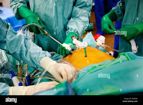 Partial Removal Of A Liver From A Living Donor By Laparoscopy For
