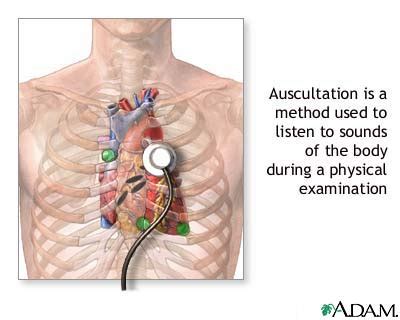 Auscultation MedlinePlus Medical Encyclopedia Image