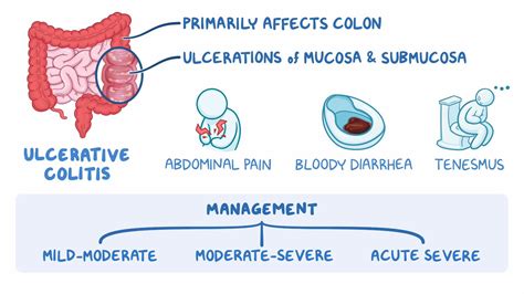 Inflammatory Bowel Disease Ulcerative Colitis Clinical Sciences Osmosis Video Library