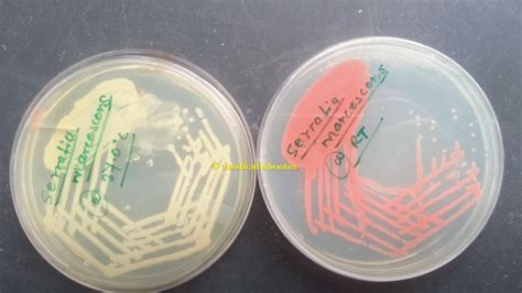 Serratia Marcescens Introduction Identification Features And