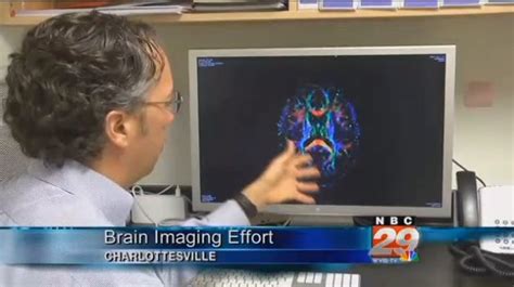 Traumatic Brain Injury Research At Uva Radiology And Medical Imaging