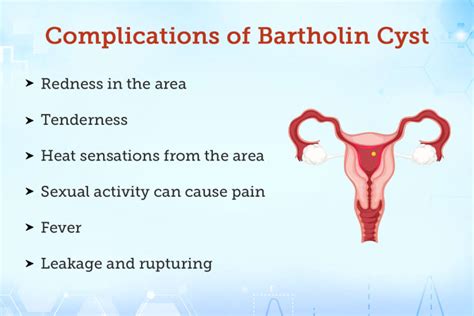 bartholin s cyst and abscess causes symptoms treatment hot sex picture