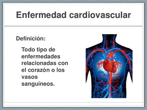 Conoce Sobre Las Enfermedades Del Sistema Circulatorio