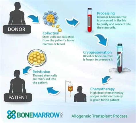 allogeneic stem cell transplantation uams stem cell transplantation and cellular therapy program