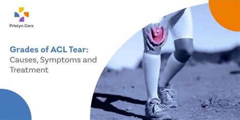 Grades Of Acl Tear Causes Symptoms And Treatment Pristyn Care