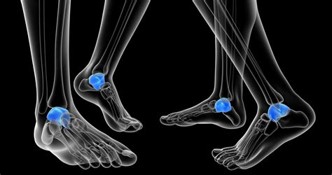 Lateral Malleolus Fracture Atl Physio