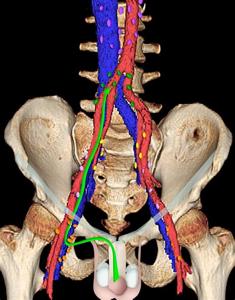 Superficial Inguinal Pathway Of Nodal Drainage Green Arrow