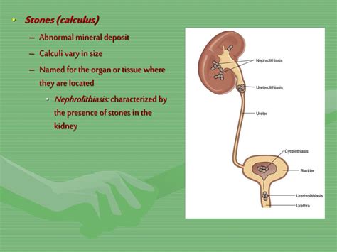 Cystalgia Is Pain In The - PPT - Chapter 9 Medical Terminology and Chapter 20 Body Structures: THE