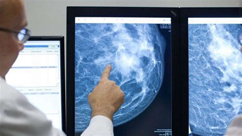 Brustkrebs Ab zur Früherkennung