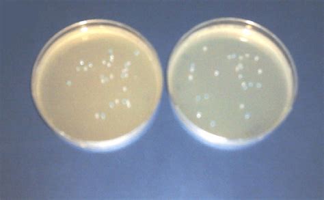 White Blue Colonies Appear In The Lb Plates White Colonies Reflect