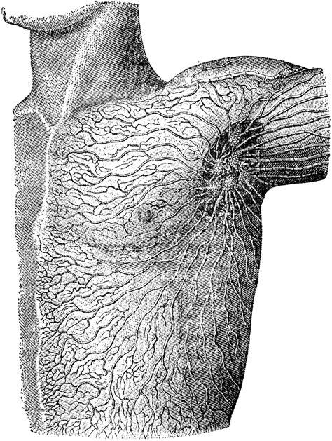 Lymphatics Of The Shoulder Clipart Etc