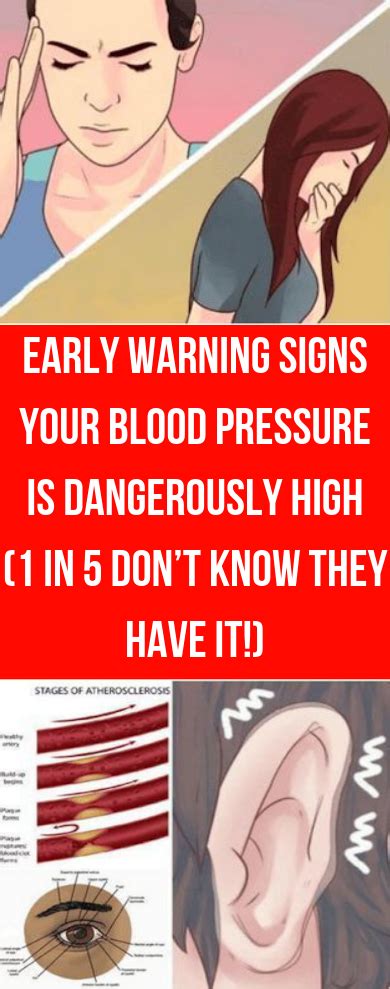 Early Warning Signs Your Blood Pressure Is Dangerously High 1 In 5 Don