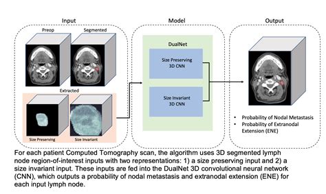 Deep Learning For Identification Of Extranodal Extension — Aim Harvard
