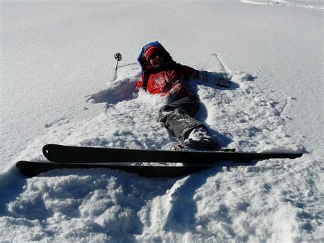 What Are The Most Common Skiing Injuries Physioroom Blog