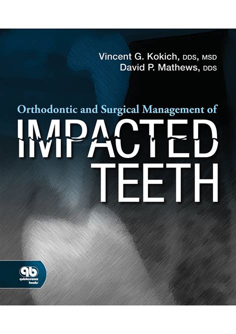 Orthodontic And Surgical Management Of Impacted Teeth Mi Tec Medical