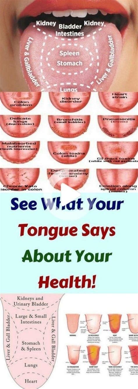 What Your Tongue Says About Your Health In 2020 Health Natural
