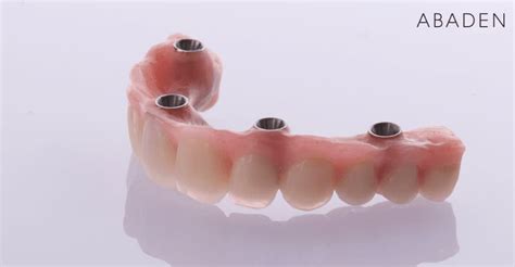 Cuáles Son Los Tipos De Dentadura Postiza Existentes Abaden Dentistas