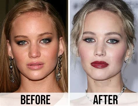 Jennifer Lawrence Had Plastic Surgery Seeing These Before And After Photos