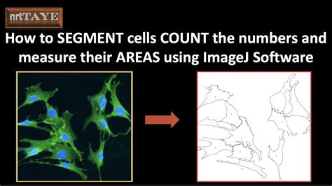 How To Segment Cells And Count The Numbers And Measure Their Areas