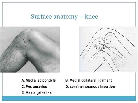 Surface Anatomy Knee A Medial Epicondyle B Medial Collateral Ligament C Pes Anserius D