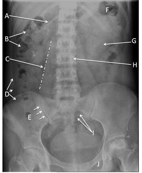 Quiz 8 Radiology Cases