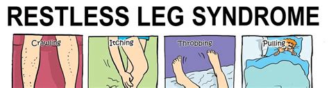 Treating Restless Leg Syndrome Drug Discovery And Development