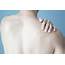Treating A Frozen Shoulder Through Massage Therapy  Blys