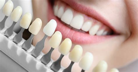 50 Shades Of White How To Choose The Right Shade For Teeth Whitening
