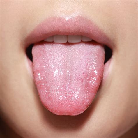 Stress Bumps On Tongue