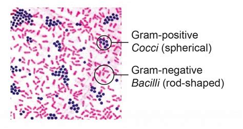 Gram Positive Vs Gram Negative Cells On A Slide Viralreka