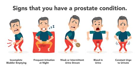 Prostate Cancer Symptoms Common And Not So Common Signs Hot Sex Picture