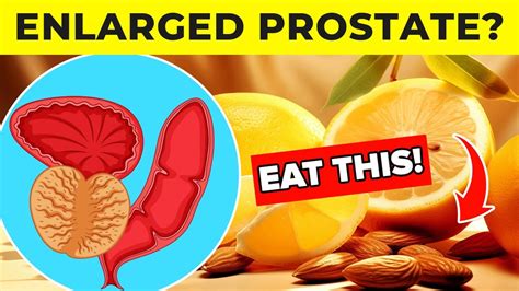 Best Foods To Eat For Enlarged Prostate Reduce Cancer Risk And Symptoms Youtube