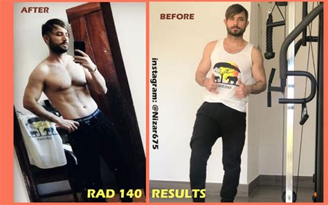 Rad 140 Results Testolone Sarm Rad 140 Before And After