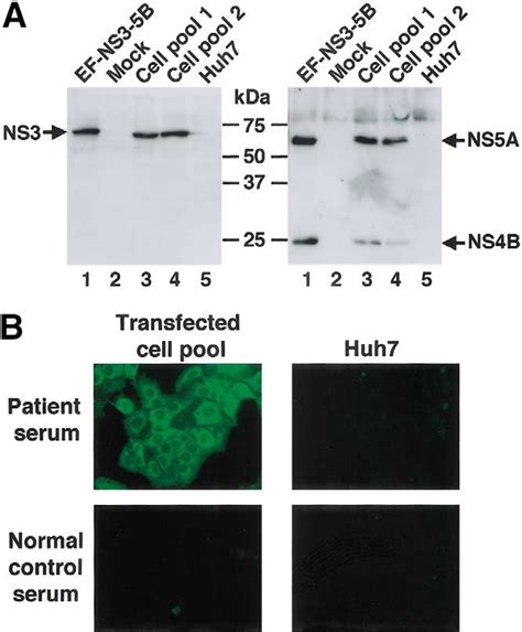 Detection Of Hcv Antigens In Transfected Huh7 Cells A Western Blot