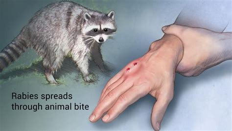 Awareness Of Rabies Help Save Lives Nandinidoctors