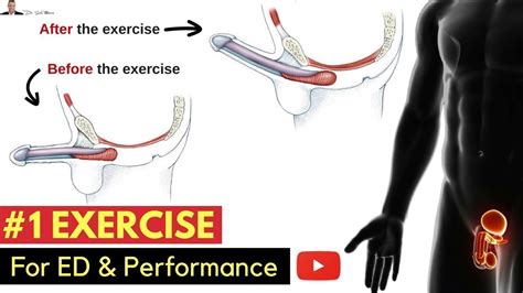 Exercise For Preventing Erectile Dysfunction Improving Your Performance In The
