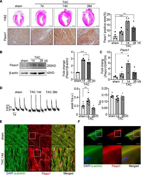 Piezo1 Mediated Mechanotransduction Promotes Cardiac Hypertrophy By