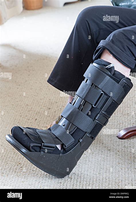 Modern Reusable Cast For Broken Ankle As Used In Uk Hospitals Stock