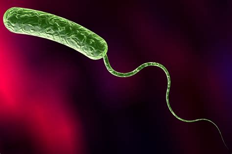 Vibrio Cholerae Krankheiten Und Vorbeugung Des Erregers Emedi