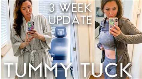 Tummy Tuck 3 Week Update Before And After Pictures And Full Experience Youtube