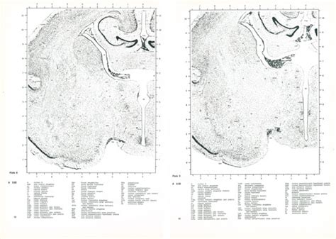 The Brain Of The Opossum Didelphus Marsupialis De Oswaldo Cruz And C